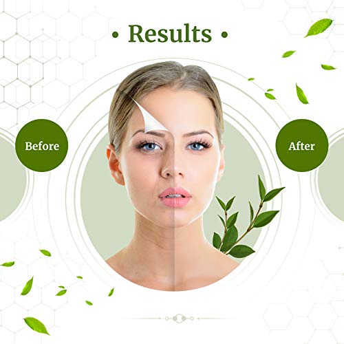 Epic Organic Night Cream Anti Aging Wrinkle Cream Reduces Wrinkles, Dark Spots, Acne Scars & Marks, Helps with Old Scar Removal, Niacinamide & Growth Factors (EGF, IGF-1, FGF and VEGF) | (1.7)