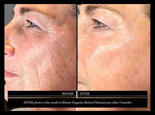 Pure Anti-Wrinkle Face & Neck Retinol Cream with Hyaluronic Acid - Premium Anti-Aging Face Moisturizer - Anti Aging Firming Facial Cream to Reduce Wrinkles, Dark Spots, Fine Lines, Sun Damage - 1.7 Oz