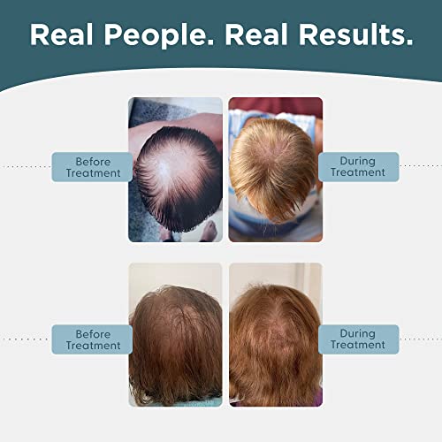 Men’s Regrowth Kit Plus: Shampoo, Conditioner, 5% Minoxidil, Leave-In Foam. Complete Anti Hair Loss and Thinning Hair Solution for Men, 1 Month Supply