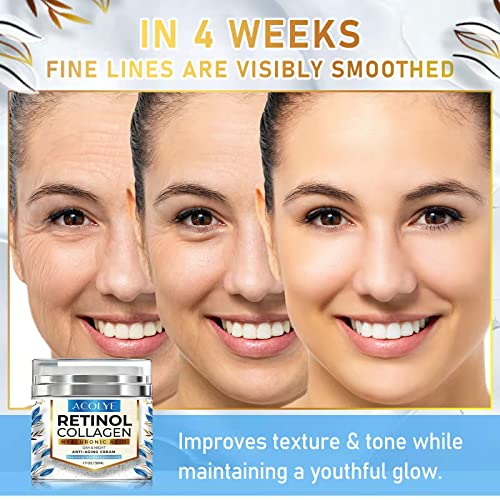 Retinol Cream for Face, Facial Moisturizer with Hyaluronic Acid 5% and Collagen-Day & Night Anti Aging Cream, Retinol Moisturizer for Face and Neck, Wrinkle Cream for Face-– For All Skin Types(1.7 oz)