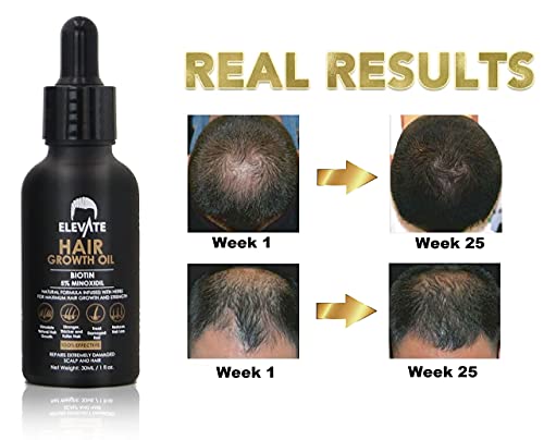 hair growth oil