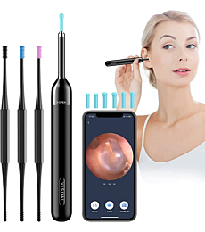 Ear Wax Removal - Ear Wax Removal Tool Camera with 1080P - Ear Wax Remover Wireless Otoscope with Light - Ear Cleaner Kit with Camera 3 Ear Spoon - Ear Camera for iOS & Android - Black