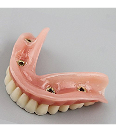 Dental Model Overdenture Inferior 4 Implants