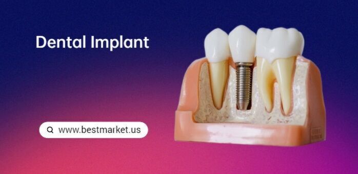 dental implant model and equipment