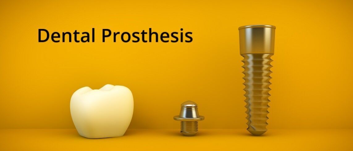 Dental Prothesis